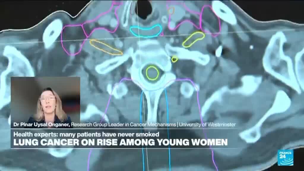 Why are lung cancer rates rising among young, fit women who have never smoked?