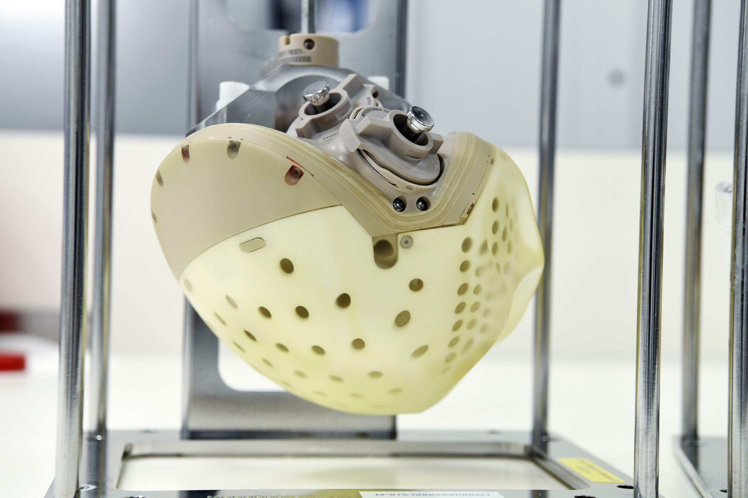 Carmat a vendu pour la première fois un coeur artificiel, en Italie