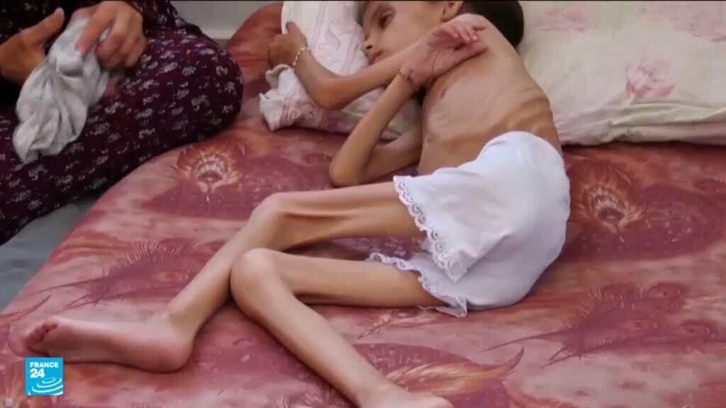 بعد عامين من الحرب في غزة.. بيوت دمرتها آلة الحرب وأجساد أنهكها الجوع والمرض