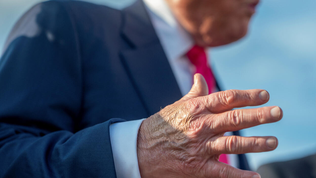 FOTO DE ARCHIVO: Maquillaje cubre parcialmente el dorso de la mano derecha del presidente de EE.UU. Donald Trump mientras habla con los miembros de los medios de comunicación a su llegada de Pennsylvania, en la Base Conjunta Andrews, Maryland, EE.UU., 15 de julio de 2025. En una rueda de prensa del 17 de julio de 2025, la secretaria de prensa de Estados Unidos, Karoline Leavitt, leyó una declaración de su médico en la que se indicaba que el presidente Trump padece una insuficiencia venosa crónica".