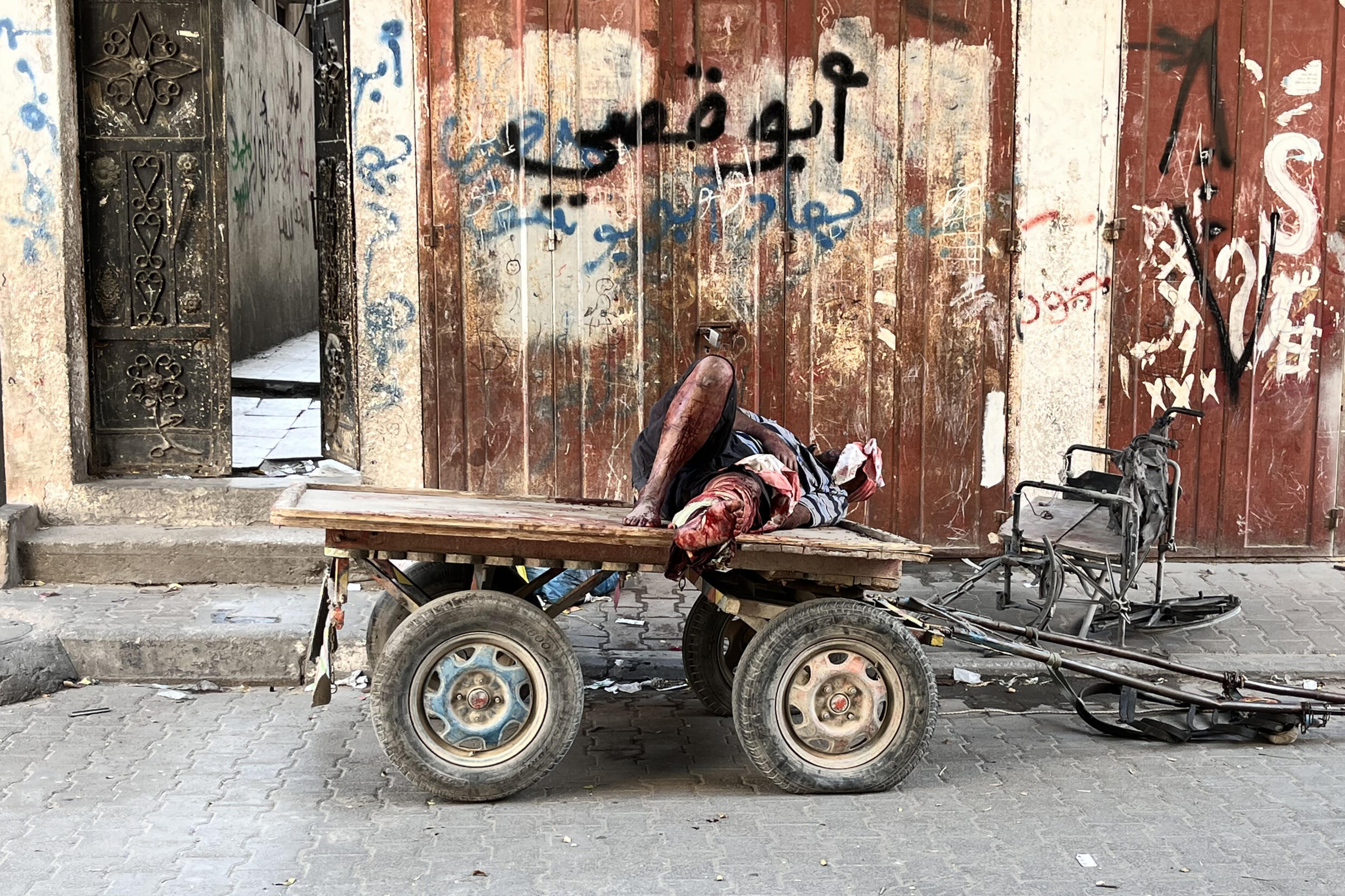 Un Palestinien blessé est allongé sur un chariot à Beit Lahia, dans le nord de la bande de Gaza, le 31 octobre 2024