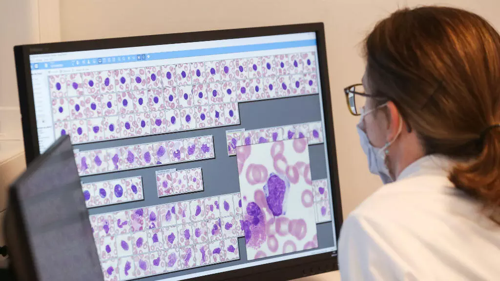 Una investigadora observa un análisis de sangre en el laboratorio de la clínica MontLegia CHC en Lieja, Bélgica, el 26 de marzo de 2020.