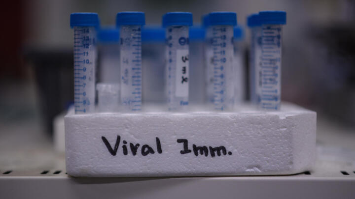 Vials displayed during a neutralising antibody test on the Middle Eastern Respiratory Syndrome (MERS) coronavirus at a laboratory at the International Vaccine Institute (IVI) in Seoul, March 11, 2020.