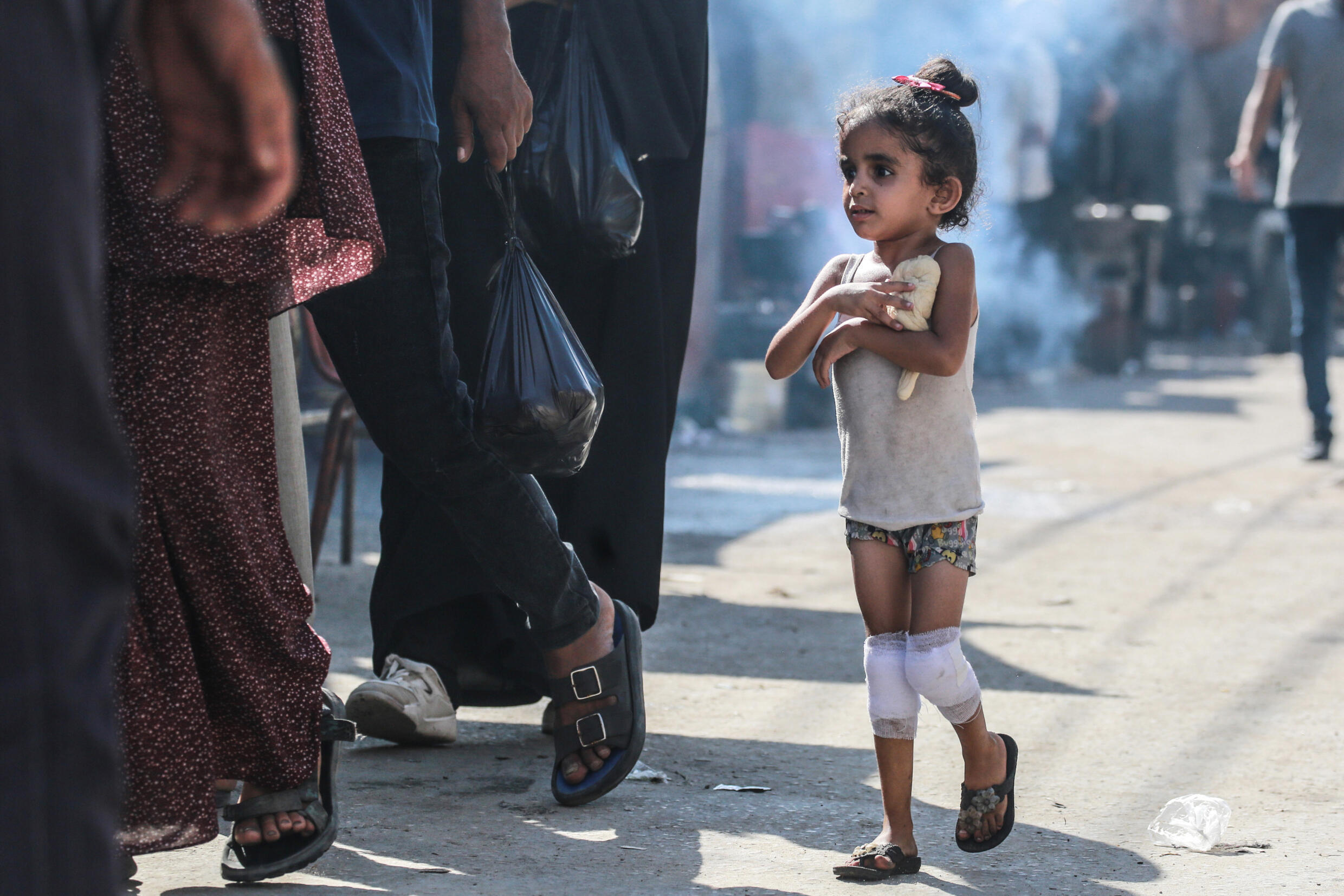 Une fillette palestinienne aux genoux bandés tient un morceau de pâte contre sa poitrine dans une rue de Deir al-Balah, dans le centre de la bande de Gaza, le 13 juin 2024