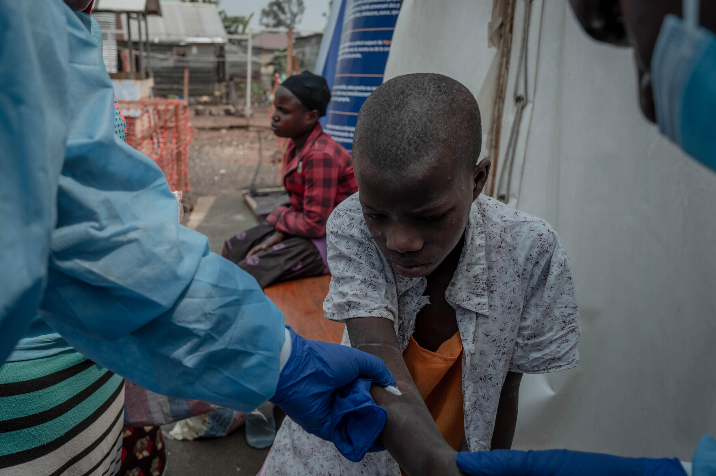 Un patient dans un centre de santé dédié au virus mpox à l'hôpital Nyiragongo, à Goma, en RDC, le 16 août 2024