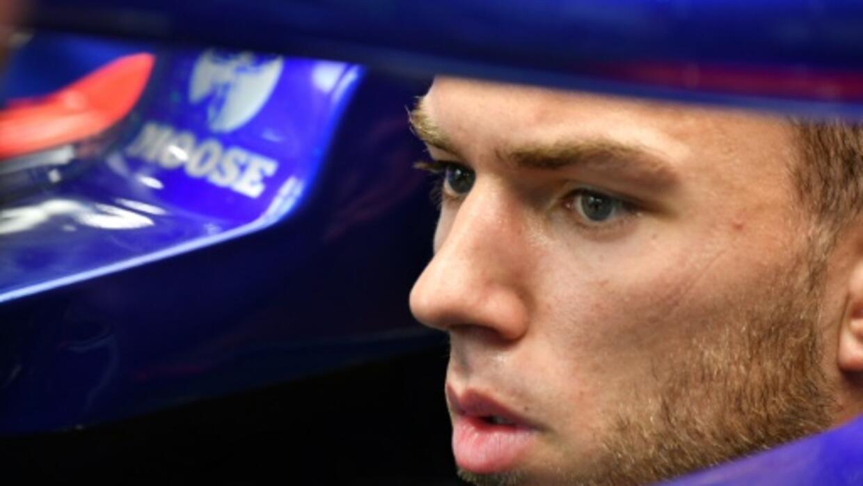 Pourquoi Les Rugbymen Ont Des Oreilles Pourquoi les pilotes de F1 ont toujours des écouteurs sur les oreilles