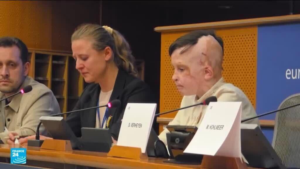 الأطفال على رأس ضحايا الحرب في أوكرانيا