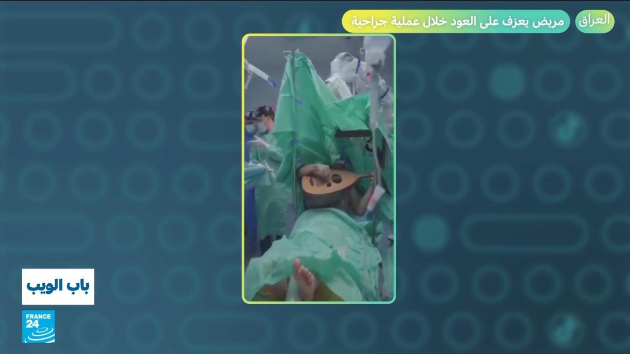 العراق.. مريض يعزف على العود خلال عملية جراحية!