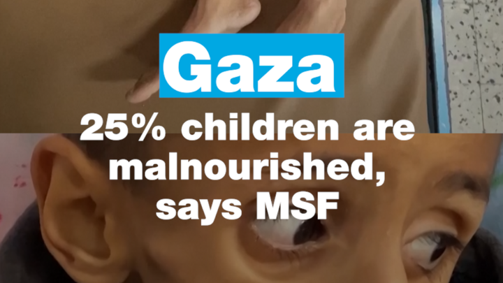Gaza: 25% children are malnourished, says MSF
