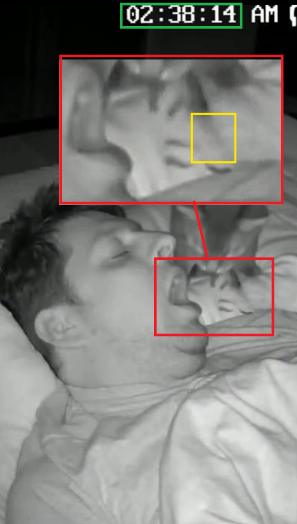 The presence of a blurred zone suggests the watermark identifying the video's source was likely removed.