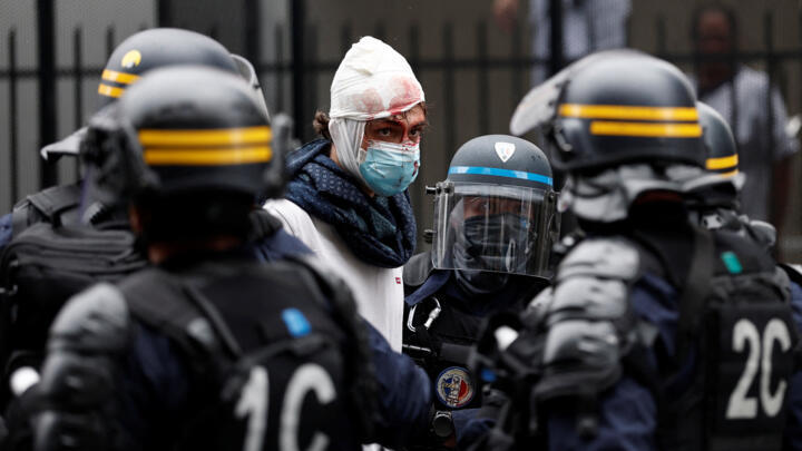 An injured masked protester is surrounded by French CRS riot police during a demonstration near the Gare du Nord train station during a day of protests in Paris.
