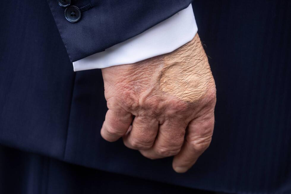 La main droite du président américain Donald Trump avant d'embarquer à bord de l'hélicoptère Marine One à la Maison Blanche, le 15 juillet 2025 à Washington