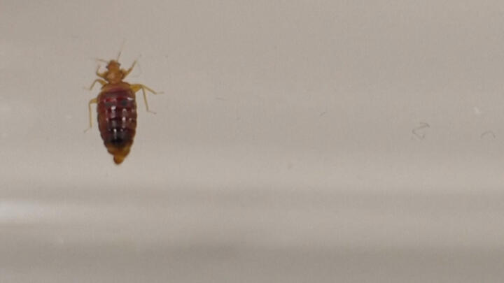 Bedbugs under a microscope (Screenshot)