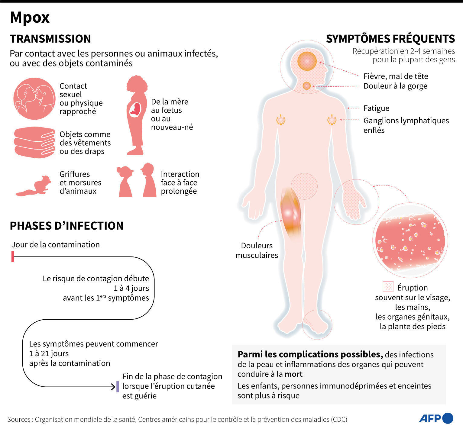 Mpox