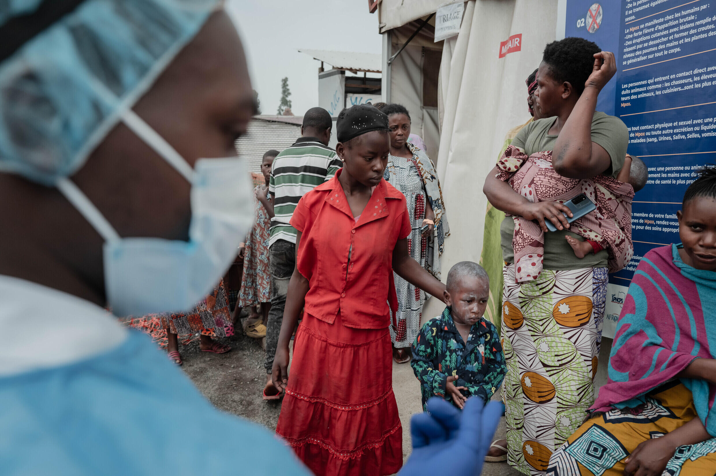 Des patients attendent leur tour dans un centre de consultation sur l'épidémie de mpox, à Goma, en République démocratique du Congo, le 17 août 2024.
