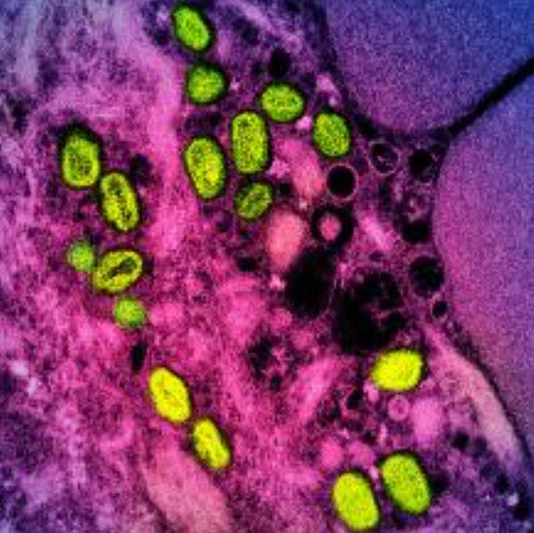 Une micrographie électronique à transmission colorisée de particules de variole du singe (vertes) trouvées dans une cellule infectée (rose et violette), cultivée en laboratoire.