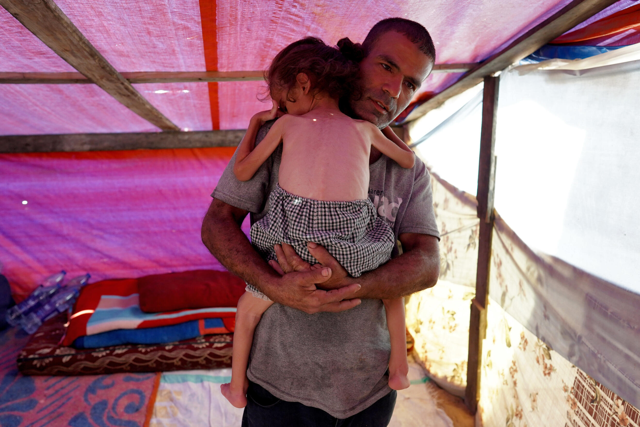 Hana Abdelrahaman al-Rai, une enfant de quatre ans souffrant de malnutrition le 4 juin 2024 dans une tente à Zawayda, dans le centre de la bande de Gaza, où une guerre oppose Israël au mouvement islamiste palestinien Hamas
