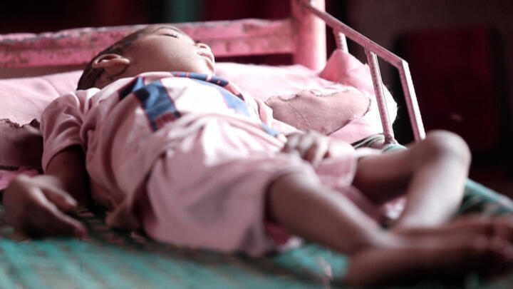 Nafisa Ali Al-Awad, 8, who is unable to walk or speak, a handicap believed to be caused by her exposure to gold mining residues, is pictured in the village of Banat, Sudan, on June 6, 2022.