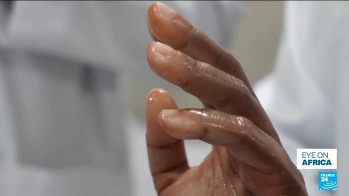 Nigerian firm revolutionises the world of prosthetics with bionic arms